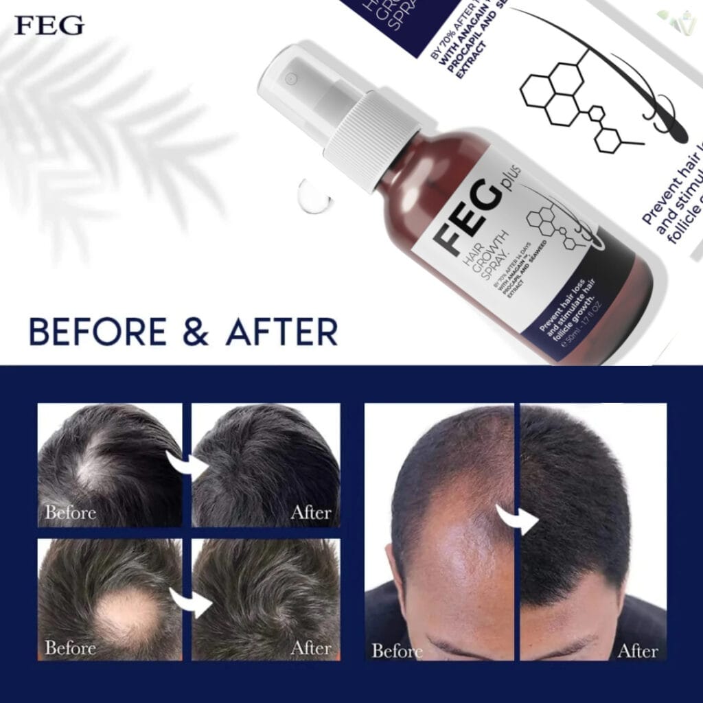 How to Use FEGPLUS Hair And Beard Growth Serum The Revolutionary Formula for Hair Regrowth Benefits 5 FEGPLUS Hair And Beard Growth Serum The Revolutionary Formula for Hair Regrowth details image